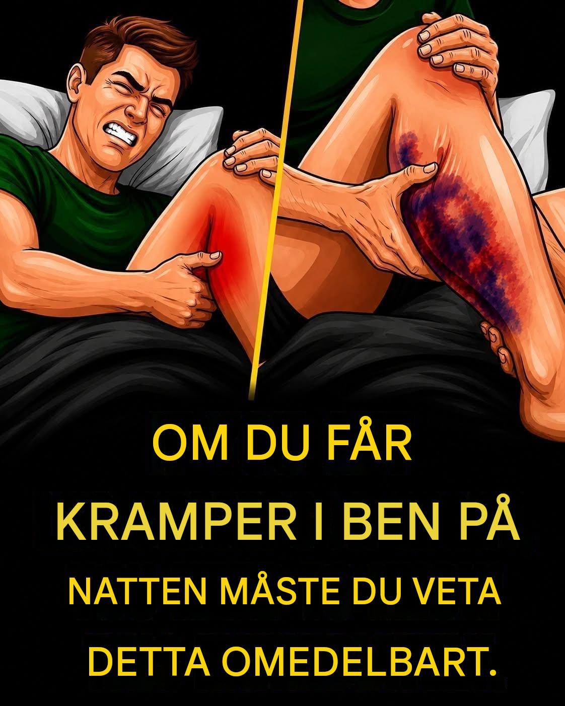 Illustration av en person som upplever kraftiga benkramper på natten, med smärta och missfärgning på benet.